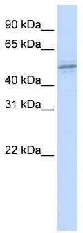WB Suggested Anti-ZNF701 Antibody Titration: 0.2-1 ug/ml; ELISA Titer: 1:312500; Positive Control: MCF7 cell lysate