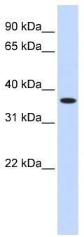 WB Suggested Anti-ZNF444 Antibody Titration: 0.2-1 ug/ml; ELISA Titer: 1:312500; Positive Control: Human Liver