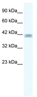 WB Suggested Anti-ZNF529 Antibody Titration: 0.2-1 ug/ml; ELISA Titer: 1:312500; Positive Control: Jurkat cell lysateZNF529 is supported by BioGPS gene expression data to be expressed in Jurkat