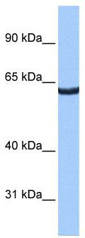 WB Suggested Anti-ZNF350 Antibody Titration: 0.2-1 ug/ml; Positive Control: HepG2 cell lysate