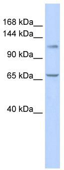 WB Suggested Anti-ZBTB10 Antibody Titration: 0.2-1 ug/ml; ELISA Titer: 1:312500; Positive Control: 721_B cell lysateZBTB10 is supported by BioGPS gene expression data to be expressed in 721_B