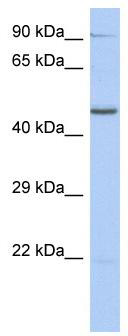 WB Suggested Anti-ZNF669 Antibody Titration: 0.2-1 ug/ml; ELISA Titer: 1:312500; Positive Control: THP-1 cell lysate