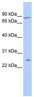 WB Suggested Anti-ZNF613 Antibody Titration: 0.2-1 ug/ml; ELISA Titer: 1:1562500; Positive Control: Jurkat cell lysate