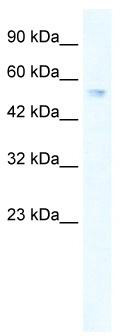 WB Suggested Anti-ZNF613 Antibody Titration: 0.2-1 ug/ml; ELISA Titer: 1:62500; Positive Control: Jurkat cell lysate