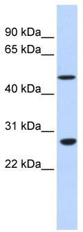 WB Suggested Anti-ZNF556 Antibody Titration: 0.2-1 ug/ml; ELISA Titer: 1:62500; Positive Control: Human Liver