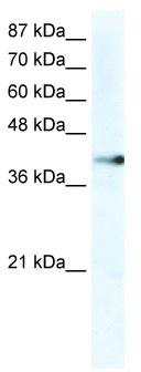 WB Suggested Anti-ZNF556 Antibody Titration: 2.5 ug/ml; ELISA Titer: 1:312500; Positive Control: HepG2 cell lysateZNF556 is supported by BioGPS gene expression data to be expressed in HepG2