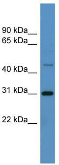WB Suggested Anti-ZNF696 Antibody Titration: 0.2-1 ug/ml; ELISA Titer: 1:312500; Positive Control: Jurkat cell lysate