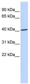 WB Suggested Anti-ZNF696 Antibody Titration: 0.2-1 ug/ml; ELISA Titer: 1:312500; Positive Control: 721_B cell lysateZNF696 is supported by BioGPS gene expression data to be expressed in 721_B