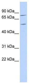 WB Suggested Anti-ZNF333 Antibody Titration: 0.2-1 ug/ml; ELISA Titer: 1:312500; Positive Control: Hela cell lysate