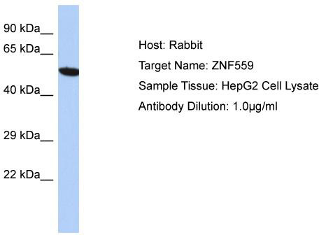 Gel: 8%SDS-PAGE<br>Lysate: 40 μg<br>Lane 1-2: A172 and Hela cell lysates<br>Primary antibody: TA370864 (GNAI1 Antibody) at dilution 1/2000<br>Secondary antibody: Goat anti rabbit IgG at 1/5000 dilution<br>Exposure time: 1 minute