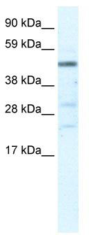 WB Suggested Anti-HSFY1 Antibody Titration: 5.0 ug/ml; ELISA Titer: 1:62500; Positive Control: Human Liver