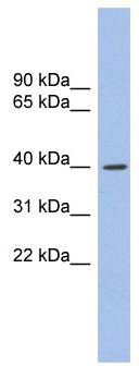 WB Suggested Anti-GLI4 Antibody Titration: 0.2-1 ug/ml; ELISA Titer: 1:12500; Positive Control: Human Stomach
