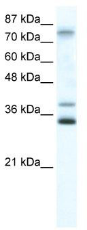 WB Suggested Anti-ZNF570 Antibody Titration: 0.2-1 ug/ml; ELISA Titer: 1:12500; Positive Control: Jurkat cell lysate