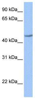 WB Suggested Anti-ZNF485 Antibody Titration: 0.2-1 ug/ml; ELISA Titer: 1:62500; Positive Control: Jurkat cell lysate