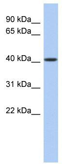 WB Suggested Anti-LASS5 Antibody Titration: 0.2-1 ug/ml; ELISA Titer: 1:12500; Positive Control: Human kidney