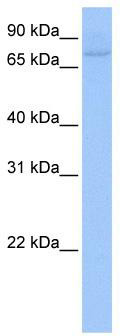 WB Suggested Anti-ZNF440 Antibody Titration: 0.2-1 ug/ml; ELISA Titer: 1:312500; Positive Control: HepG2 cell lysate