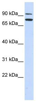 WB Suggested Anti-ZNF440 Antibody Titration: 0.2-1 ug/ml; ELISA Titer: 1:12500; Positive Control: Human Spleen