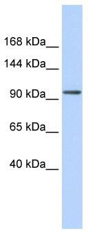 WB Suggested Anti-ZNF560 Antibody Titration: 0.2-1 ug/ml; ELISA Titer: 1:312500; Positive Control: Hela cell lysate