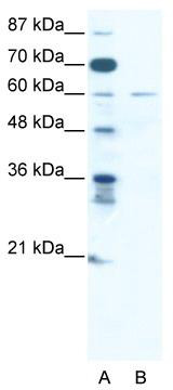 WB Suggested Anti-ZNF92 Antibody Titration: 2.5 ug/ml; ELISA Titer: 1:62500; Positive Control: Jurkat cell lysate