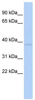WB Suggested Anti-ZNF75A Antibody Titration: 0.2-1 ug/ml; ELISA Titer: 1:12500; Positive Control: MCF7 cell lysate
