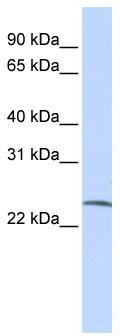 WB Suggested Anti-SSX6 Antibody Titration: 0.2-1 ug/ml; ELISA Titer: 1:1562500; Positive Control: HepG2 cell lysate