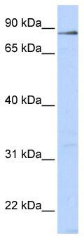 WB Suggested Anti-L3MBTL4 Antibody Titration: 0.2-1 ug/ml; ELISA Titer: 1:1562500; Positive Control: 293T cell lysate