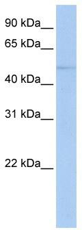 WB Suggested Anti-ZNF610 Antibody Titration: 0.2-1 ug/ml; ELISA Titer: 1:62500; Positive Control: 293T cell lysate