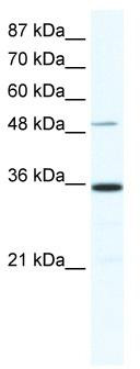 WB Suggested Anti-ZNF610 Antibody Titration: 0.2-1 ug/ml; ELISA Titer: 1:62500; Positive Control: HepG2 cell lysate