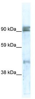 WB Suggested Anti-ZNF227 Antibody Titration: 0.2-1 ug/ml; ELISA Titer: 1:1562500; Positive Control: Human Small Intestine