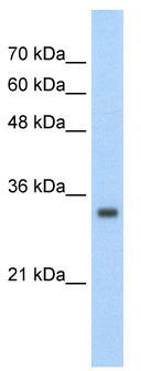 WB Suggested Anti-ZNF227 Antibody Titration: 2.5 ug/ml; Positive Control: HepG2 cell lysate