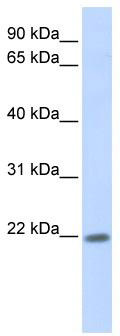 WB Suggested Anti-ZNF534 Antibody Titration: 0.2-1 ug/ml; ELISA Titer: 1:312500; Positive Control: Human Placenta