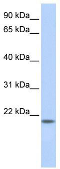 WB Suggested Anti-FLJ33706 Antibody Titration: 0.2-1 ug/ml; ELISA Titer: 1:312500; Positive Control: HepG2 cell lysate