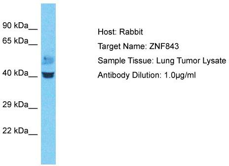 Host: Rabbit; Target Name: ZNF843; Sample Tissue: Lung Tumor lysates; Antibody Dilution: 1.0 ug/ml