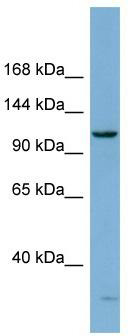 WB Suggested Anti-DHX15 Antibody Titration: 0.2-1 ug/ml; ELISA Titer: 1:62500; Positive Control: THP-1 cell lysate