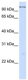WB Suggested Anti-DHX15 Antibody Titration: 0.2-1 ug/ml; ELISA Titer: 1:312500; Positive Control: 293T cell lysateDHX15 is supported by BioGPS gene expression data to be expressed in HEK293T