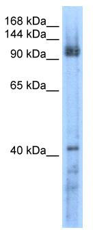 WB Suggested Anti-RECQL5 Antibody Titration: 0.2-1 ug/ml; ELISA Titer: 1:62500; Positive Control: Transfected 293T