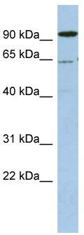 WB Suggested Anti-DDX52 Antibody Titration: 0.2-1 ug/ml; ELISA Titer: 1:312500; Positive Control: OVCAR-3 cell lysate
