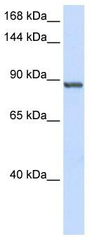 WB Suggested Anti-INTS6 Antibody Titration: 0.2-1 ug/ml; ELISA Titer: 1:62500; Positive Control: Human Placenta