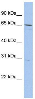 WB Suggested Anti-DQX1 Antibody Titration: 0.2-1 ug/ml; ELISA Titer: 1:312500; Positive Control: OVCAR-3 cell lysate