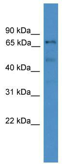 WB Suggested Anti-DDX51 Antibody Titration: 0.2-1 ug/ml; ELISA Titer: 1:312500; Positive Control: 293T cell lysate