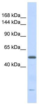 WB Suggested Anti-DNA2L Antibody Titration: 0.2-1 ug/ml; ELISA Titer: 1:312500; Positive Control: Human heart