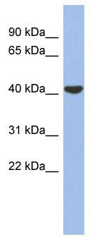 WB Suggested Anti-GJD4 Antibody Titration: 0.2-1 ug/ml; ELISA Titer: 1:62500; Positive Control: PANC1 cell lysate