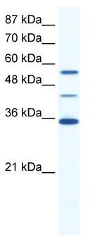 WB Suggested Anti-ALX4 Antibody Titration: 0.625 ug/ml; ELISA Titer: 1:312500; Positive Control: HepG2 cell lysate