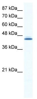 WB Suggested Anti-ALX4 Antibody Titration: 0.2-1 ug/ml; ELISA Titer: 1:12500; Positive Control: HepG2 cell lysate