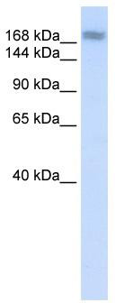 WB Suggested Anti-ADAR Antibody Titration: 0.2-1 ug/ml; ELISA Titer: 1:62500; Positive Control: Human Muscle