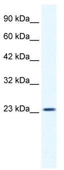 WB Suggested Anti-KCTD11 Antibody Titration: 1.25 ug/ml; ELISA Titer: 1:62500; Positive Control: HepG2 cell lysate