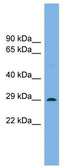 WB Suggested Anti-Noto Antibody Titration: 0.2-1 ug/ml; ELISA Titer: 1:62500; Positive Control: Mouse Brain