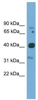 WB Suggested Anti-Foxq1 Antibody Titration: 0.2-1 ug/ml; Positive Control: Mouse Brain