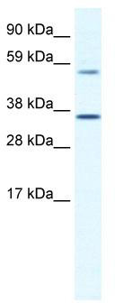 WB Suggested Anti-MESP2 Antibody Titration: 1.25 ug/ml; ELISA Titer: 1:62500; Positive Control: SP2/0 cell lysate
