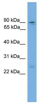 WB Suggested Anti-Zfy1 Antibody Titration: 0.2-1 ug/ml; ELISA Titer: 1:12500; Positive Control: Mouse Thymus